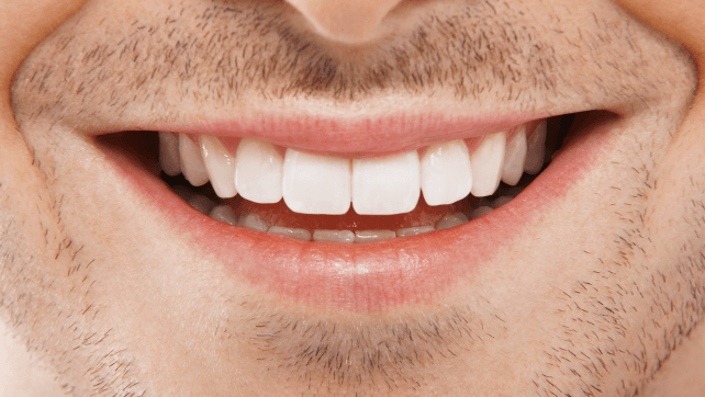 5 easy tips for naturally white teeth