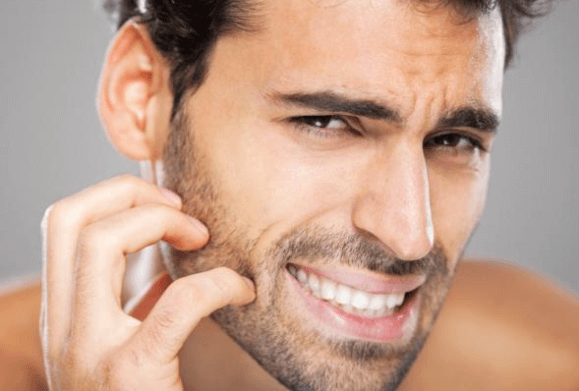 Men's sensitive skin tips - do's and don'ts